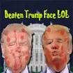 Beaten Trump Face LOL
